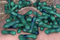 RKI در مورد شیوع بیماری در آلمان هشدار می دهد